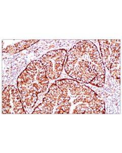 Cell Signaling Aif (D39d2) Xp Rabbit mAb