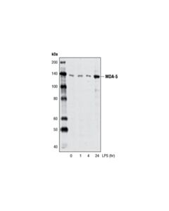 Cell Signaling Mda-5 (D74e4) Rabbit mAb