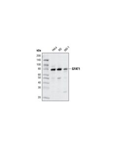 Cell Signaling Gfat1 (D12f4) Rabbit mAb