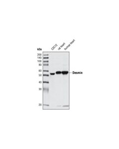 Cell Signaling Desmin (D93f5) Xp Rabbit mAb