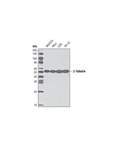Cell Signaling Beta-Tubulin (9f3) Rabbit mAb (Hrp Conjugate)