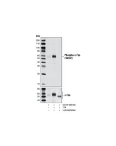 Cell Signaling Phospho-C-Fos (Ser32) (D82c12) Xp Rabbit mAb