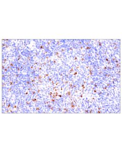 Cell Signaling Ctla-4 (E2v1z) Rabbit mAb