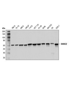 Cell Signaling SHOC2 (D7N1A) Rabbit mAb 20 uL