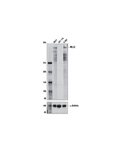 Cell Signaling MLL3 (D1S1V) Rabbit mAb 20 uL