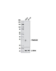 Cell Signaling Psa/Klk3 (D6b1) Xp Rabbit mAb