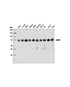 Cell Signaling Drp1 (D8h5) Rabbit mAb