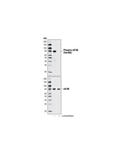 Cell Signaling Phospho-Eif4b (Ser406) Antibody