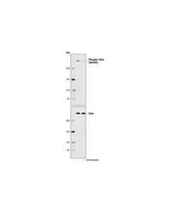 Cell Signaling Phospho-Talin (Ser425) Antibody