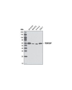 Cell Signaling Terf2ip (D9h4) Rabbit mAb