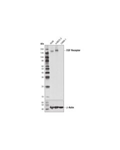 Cell Signaling Egf Receptor (D1d4j) Xp Rabbit mAb