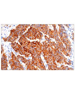 Cell Signaling Transferrin Receptor/CD71 (10F11) Mouse mAb