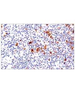 Cell Signaling Tnfrsf8/Cd30 (E4l4i) Xp Rabbit mAb