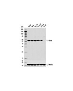 Cell Signaling Fascin (55k-2) Mouse mAb 20 uL