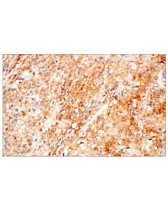 Cell Signaling DOG1/Anoctamin 1 (K9) Mouse mAb