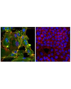 Cell Signaling CD105/Endoglin (F5T8J) Rabbit mAb