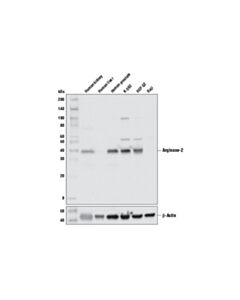 Cell Signaling Arginase-2 (D9j1n) Xp Rabbit mAb