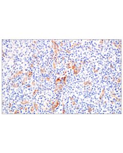 Cell Signaling Cd93/C1qr (E5h9b) Rabbit mAb