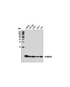 Cell Signaling S100a10 (4e7e10) Mouse mAb