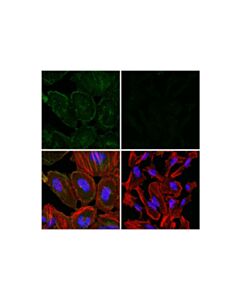 Cell Signaling Numb (F4G6B) Mouse mAb 20 uL