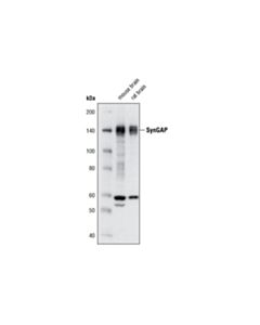 Cell Signaling SynGAP (D78B11) Rabbit mAb 20 uL