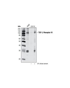 Cell Signaling Tgf-Beta Receptor Iii (D11g10) Rabbit mAb