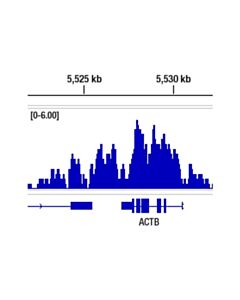 Cell Signaling Ubiquityl-Histone H2b (Lys120) (D11) Xp Rabbit mAb