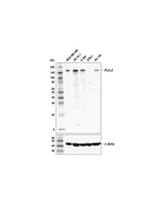 Cell Signaling PLCgamma2 (E5U4T) Rabbit mAb 20 uL