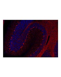 Cell Signaling β3-Tubulin (D65A4) XP® Rabbit mAb (Alexa Fluor® 647 Conjugate); 100 µl