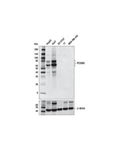 Cell Signaling PCSK9 (D5K4S) Rabbit mAb 20 uL