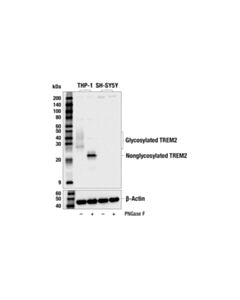 Cell Signaling TREM2 (E4J7A) Rabbit mAb 20 uL
