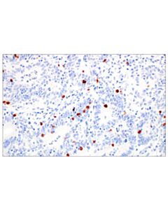 Cell Signaling Trdc/Tcrdelta (E2e9t) Xp Rabbit mAb