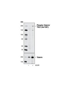 Cell Signaling Phospho-Tuberin/Tsc2 (Ser1387) Antibody
