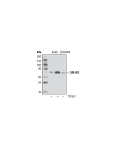 Cell Signaling Betaig-H3 (D31b8) Xp Rabbit mAb