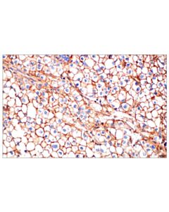 Cell Signaling Cd81 (D3n2d) Rabbit mAb