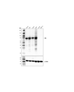 Cell Signaling Btk (D6t2c) Mouse mAb