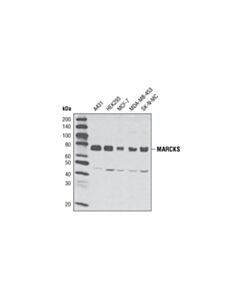 Cell Signaling Marcks (D88d11) Xp Rabbit mAb