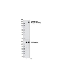Cell Signaling Egf Receptor Control Cell Extracts