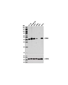 Cell Signaling CYR61 (D4H5D) XP Rabbit mAb (BSA and Azide Free)