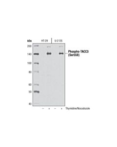 Cell Signaling Phospho-Tacc3 (Ser558) Antibody