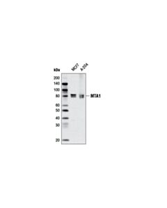 Cell Signaling Mta1 (D40d1) Xp Rabbit mAb