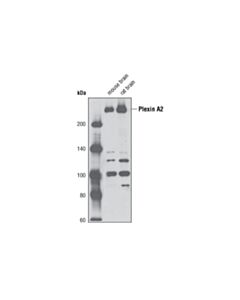 Cell Signaling Plexin A2 (D42b5) Rabbit mAb