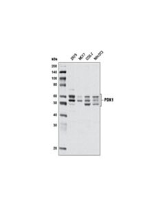 Cell Signaling Pdk1 (D37a7) Rabbit mAb