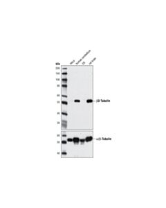 Cell Signaling Beta3-Tubulin (D65a4) Xp Rabbit mAb