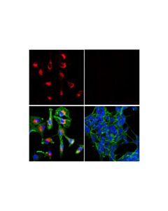 Cell Signaling Notch2 (D76a6) Xp® Rabbit mAb (Alexa Fluor® 555 Conjugate)
