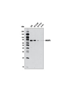 Cell Signaling AKAP5 (D28G3) Rabbit mAb 20 uL