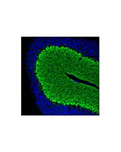 Cell Signaling Eaat1 (D44e2) Xp Rabbit mAb