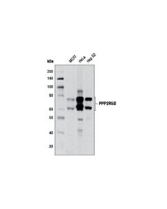 Cell Signaling PPP2R5D (H5D12) Mouse mAb 20 uL