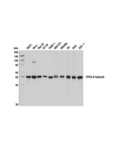 Cell Signaling Ppp2r2a (2g9) Mouse mAb