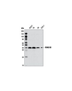 Cell Signaling Ring1b (D22f2) Xp Rabbit mAb